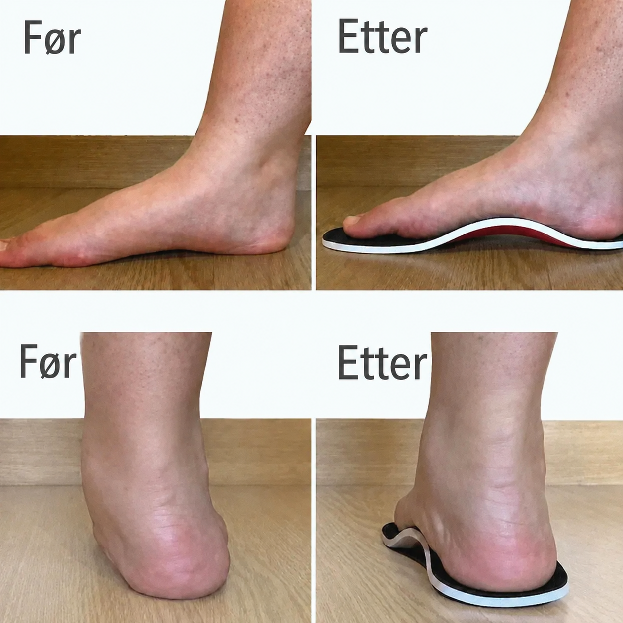 SteadyStep™ – Innleggssåler med fotbuestøtte